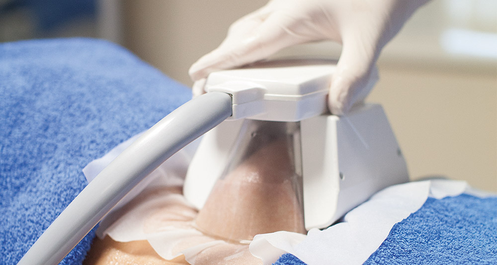 How Fat Freezing and HIFU Work Together? 2 Multiple Areas in One Session HIFU and Fat Freezing Chippenham