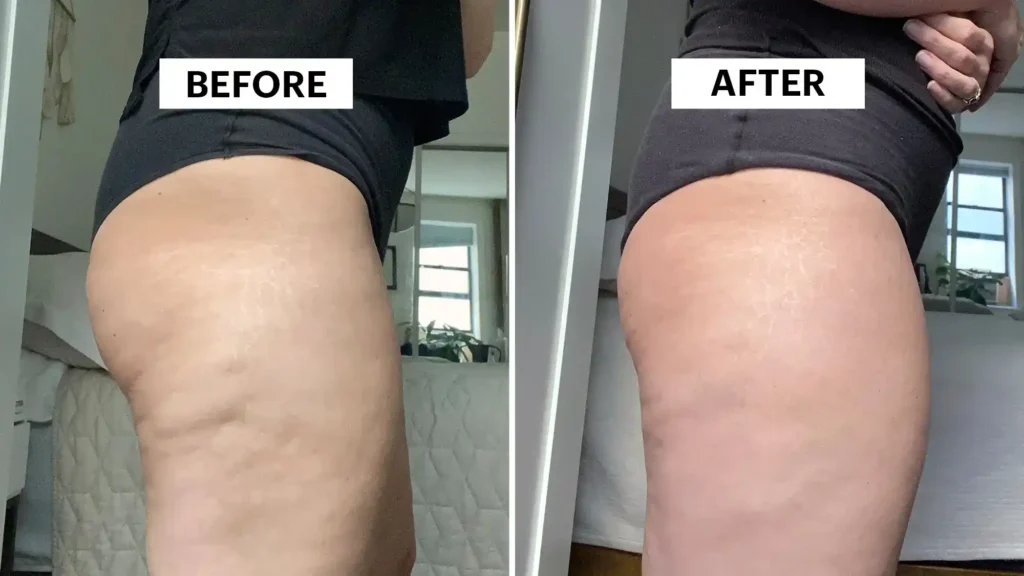 Do Toning Exercise Chippenham Really Tackle Cellulite?